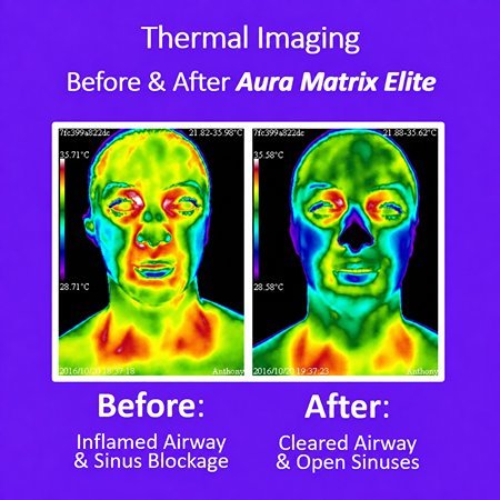 thermal image results